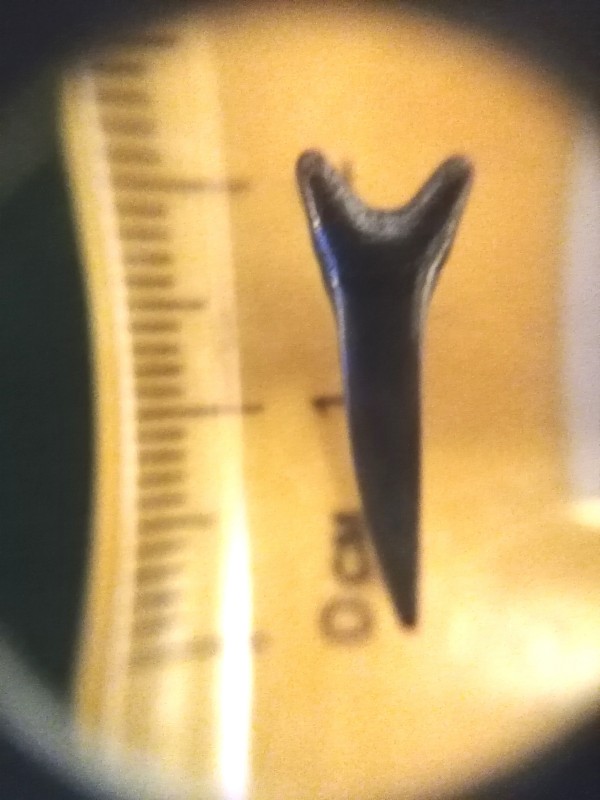 Tand 2 foto 1