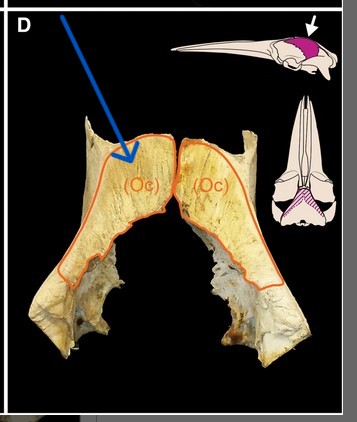 Facial Telescoping_1.jpg