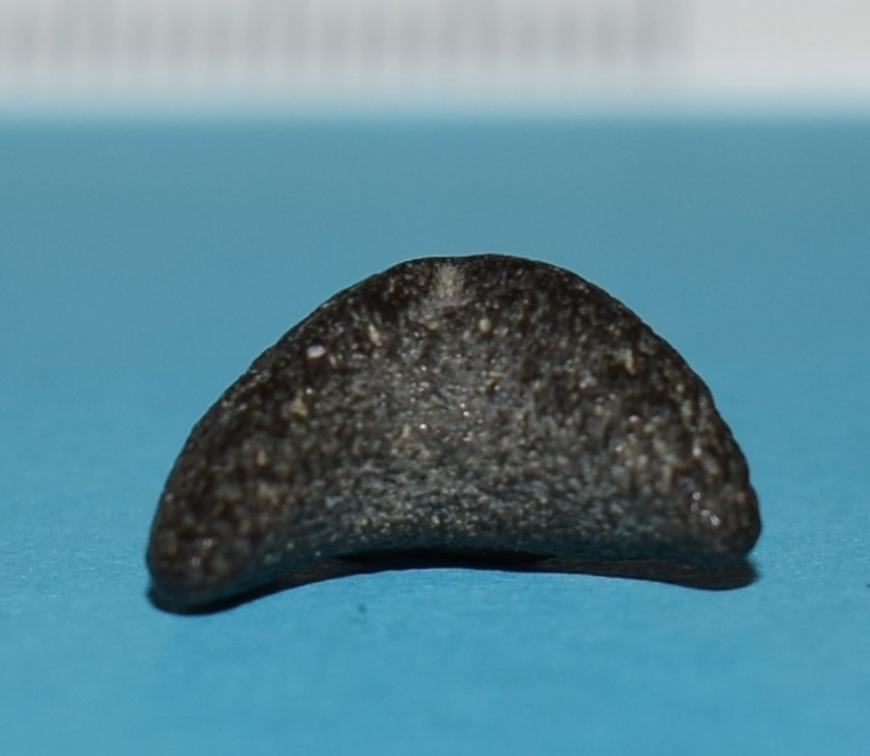 tand 1 (onderkant)